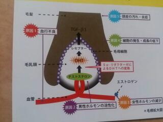 毛根拡大図