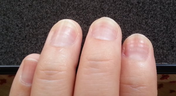 20130405_084911tume2.jpg