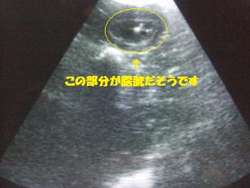 018_convert_20120814022452.jpg