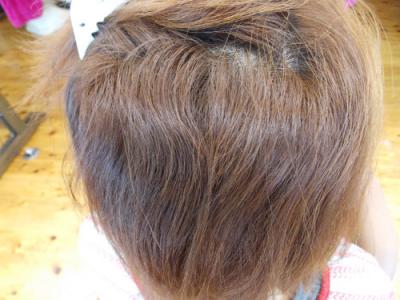 根元クセ