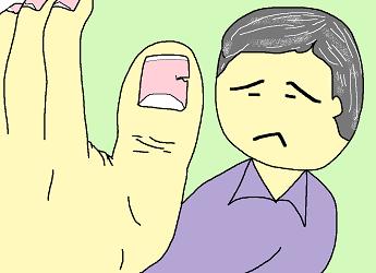 われた爪