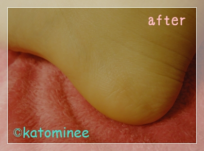after.jpg