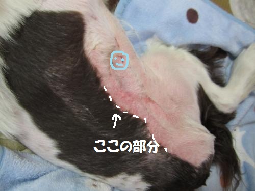 縫合
