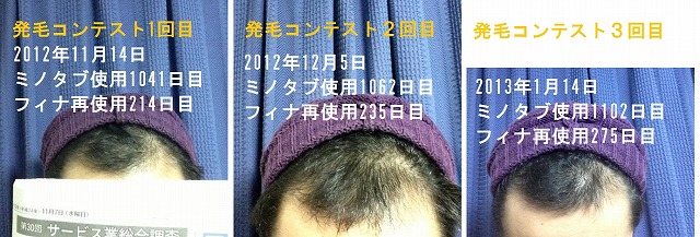 発毛①