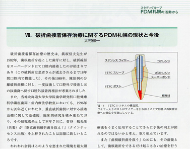 日本歯科評論11月号掲載論文