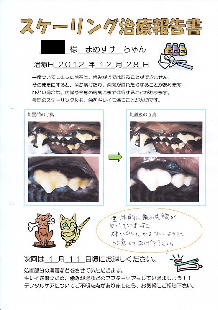 1228歯石除去12