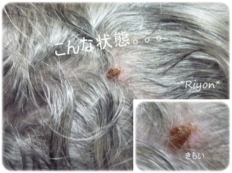 出来物③