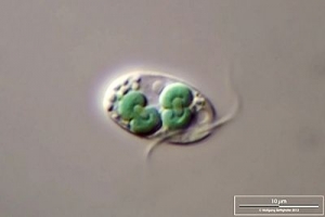 Cyanophora paradoxa