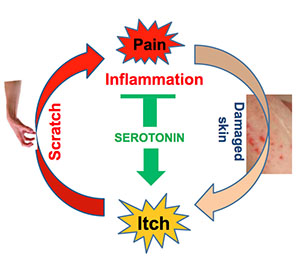 itch cycle