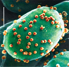 Acanthocystis turfacea Chlorella virus 1