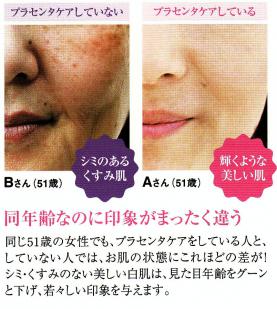 若返りの美容成分!エイジングケアと健康維持にプラセンタ!